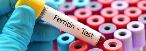 בדיקת רמות פריטין בדם (Ferritin) - תמונה